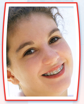 child with braces